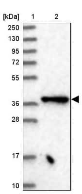 Western Blot: Elp4 Antibody [NBP2-47473]