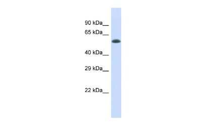 Western Blot: Elp4 Antibody [NBP3-10631]