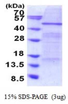 SDS-PAGE: Recombinant Human Elp4 His Protein [NBP2-51857]