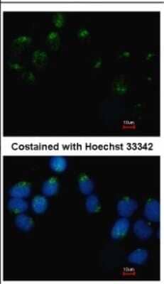 Immunocytochemistry/ Immunofluorescence: Embigin/EMB Antibody [NBP2-16324]