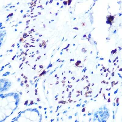 Immunohistochemistry-Paraffin: Emerin Antibody (10Y5K9) [NBP3-16351]