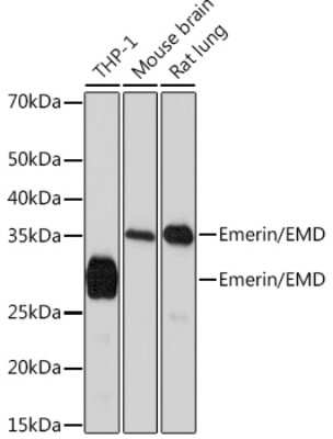 Western Blot: Emerin Antibody (10Y5K9) [NBP3-16351]