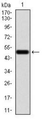 Western Blot: Emerin Antibody (8F5A8)BSA Free [NBP2-52459]