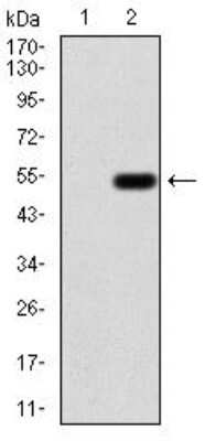 Western Blot: Emerin Antibody (8F5G2)BSA Free [NBP2-52460]