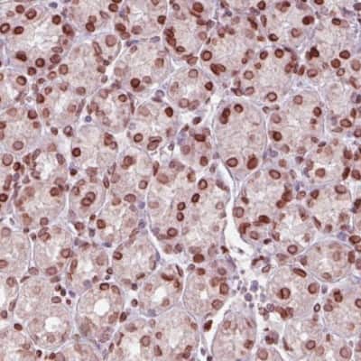 Immunohistochemistry-Paraffin: Emerin Antibody (CL0201) [NBP2-52876]