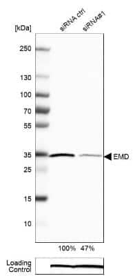 Western Blot: Emerin Antibody (CL0201) [NBP2-52876]