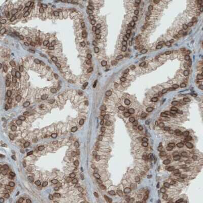 Immunohistochemistry-Paraffin: Emerin Antibody (CL0203) [NBP2-52877]