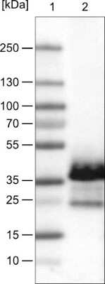 Western Blot: Emerin Antibody (CL0203) [NBP2-52877]