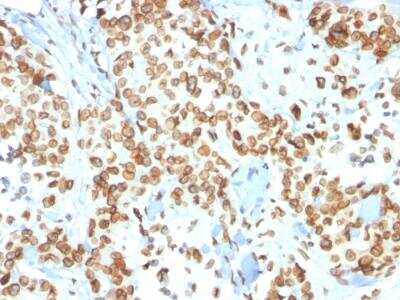 Immunohistochemistry-Paraffin: Emerin Antibody (EMD/2167) - Azide and BSA Free [NBP2-79918]