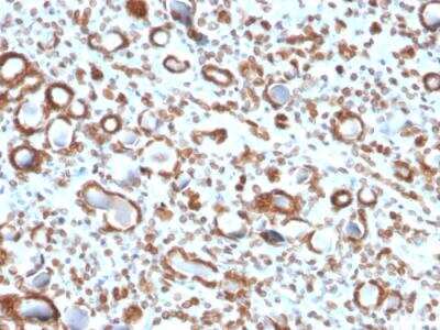 Immunohistochemistry-Paraffin: Emerin Antibody (EMD/2167) - Azide and BSA Free [NBP2-79918]