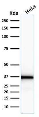 Western Blot: Emerin Antibody (EMD/2167)Azide and BSA Free [NBP2-79918]