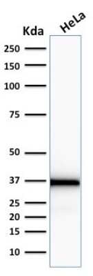 Western Blot: Emerin Antibody (EMD/2167) [NBP2-79784]