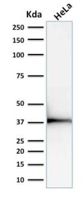 Western Blot: Emerin Antibody (EMD/2168) [NBP3-07151]