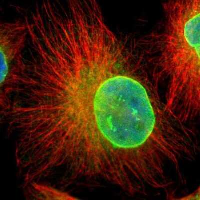 Immunocytochemistry/ Immunofluorescence: Emerin Antibody [NBP1-87692]