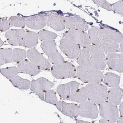 Immunohistochemistry-Paraffin: Emerin Antibody [NBP1-87692]