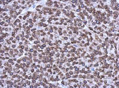 Immunohistochemistry-Paraffin: Emerin Antibody [NBP2-16326]