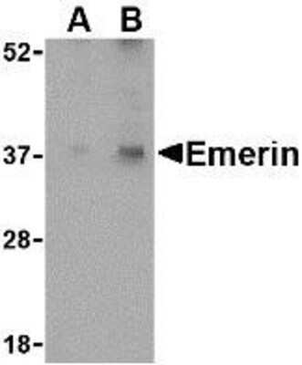 Western Blot: Emerin AntibodyBSA Free [NBP1-76757]