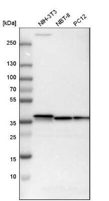 Western Blot: Emerin Antibody [NBP1-87692]