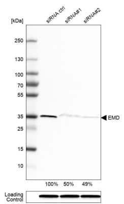 Western Blot: Emerin Antibody [NBP1-87692]