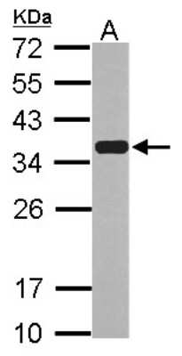 Western Blot: Emerin Antibody [NBP2-16326]