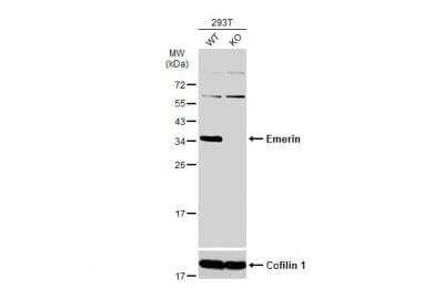 Western Blot: Emerin Antibody [NBP2-16326]