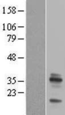 Western Blot: Emerin Overexpression Lysate [NBL1-10253]