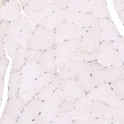Immunohistochemistry-Paraffin: Emx1 Antibody [NBP1-86500]