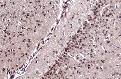 Immunohistochemistry-Paraffin: Emx1 Antibody [NBP3-13392]