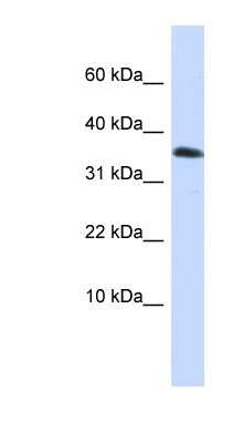 Western Blot: Emx1 Antibody [NBP1-79221]