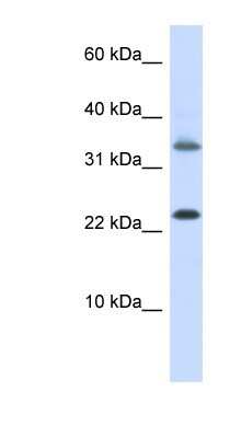 Western Blot: Emx1 Antibody [NBP1-79222]