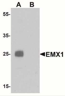 Western Blot: Emx1 AntibodyBSA Free [NBP2-41151]