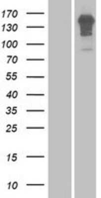 Western Blot: Enamelin Overexpression Lysate [NBP2-06111]