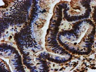 Immunohistochemistry-Paraffin: Endo G Antibody (OTI5F1) [NBP2-01696]