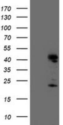 Western Blot: Endo G Antibody (OTI5F1) [NBP2-01696]