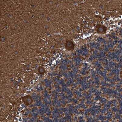 Immunohistochemistry: Endo G Antibody [NBP1-86011]