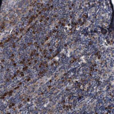 Immunohistochemistry-Paraffin: Endo G Antibody [NBP1-87554]