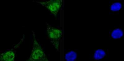Immunocytochemistry/ Immunofluorescence: Endo G Antibody (JU31-30) [NBP2-75480]