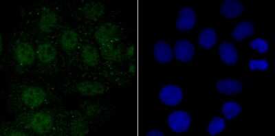 Immunocytochemistry/ Immunofluorescence: Endo G Antibody (JU31-30) [NBP2-75480]