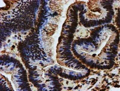 Immunohistochemistry: Endo G Antibody (OTI5F1) - Azide and BSA Free [NBP2-70645]