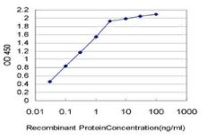 ELISA: Endocan/ESM-1 Antibody (6D4) [H00011082-M02]