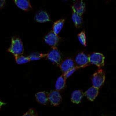 Immunocytochemistry/ Immunofluorescence: Endoglin/CD105 Antibody (3A9) - Azide and BSA Free [NBP2-80719]