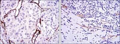 Immunohistochemistry: Endoglin/CD105 Antibody (3A9) - Azide and BSA Free [NBP2-80719]