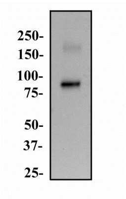 Western Blot: Endoglin/CD105 Antibody (3A9)Azide and BSA Free [NBP2-80719]