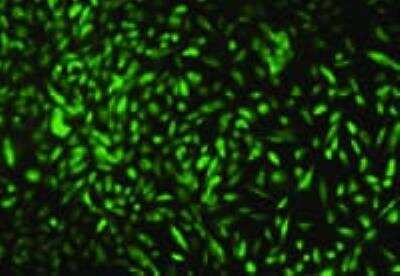 Immunocytochemistry/ Immunofluorescence: Endoglin/CD105 Antibody (3A9) - BSA Free [NBP2-22122]
