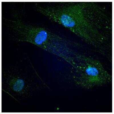 Immunocytochemistry/ Immunofluorescence: Endoglin/CD105 Antibody (3A9) - BSA Free [NBP2-22122]