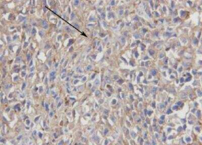 Immunohistochemistry-Paraffin: Endoglin/CD105 Antibody (3A9) - BSA Free [NBP2-22122]