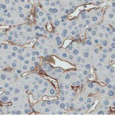 Immunohistochemistry-Paraffin: Endoglin/CD105 Antibody (CL1912) [NBP2-34493]