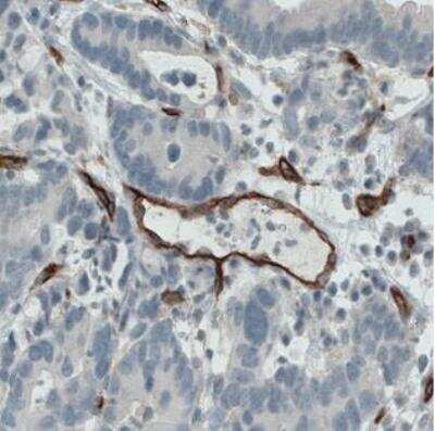 Immunohistochemistry-Paraffin: Endoglin/CD105 Antibody (CL1912) [NBP2-34493]