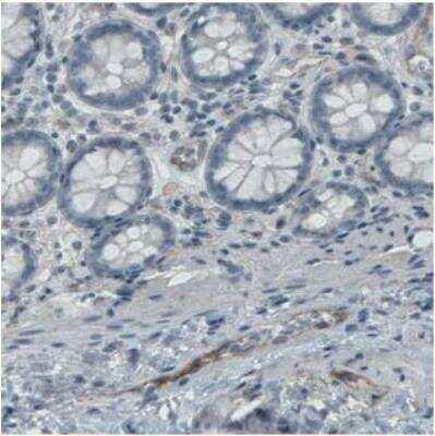 Immunohistochemistry-Paraffin: Endoglin/CD105 Antibody (CL1912) [NBP2-34493]