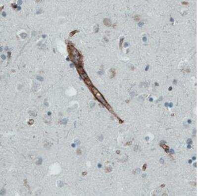 Immunohistochemistry-Paraffin: Endoglin/CD105 Antibody (CL1912) [NBP2-34493]